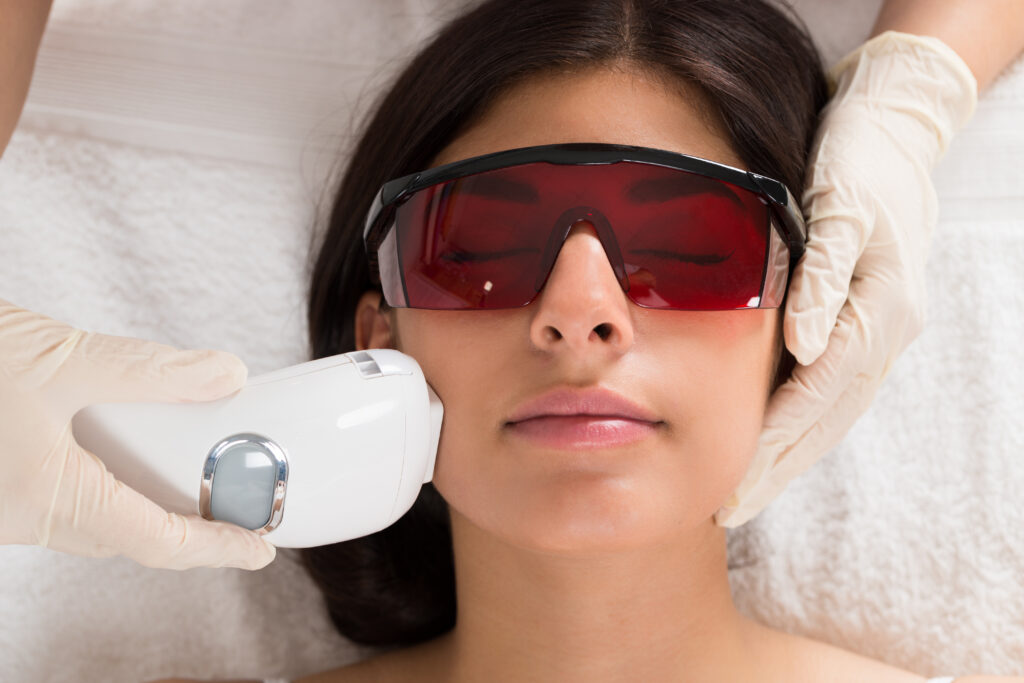 Aerolase Neo Elite Laser Skin Treatments in San Jose CA at